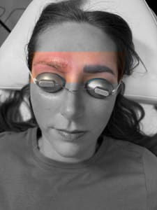 Eyebrow Tattoo result by New Skin Aesthetics in Lincoln, NE