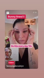 Eyebrow Tattoo result by New York Beauty Clinic in Brooklyn, NY