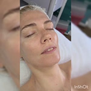 Eyebrow Tattoo result by Nu Age Aesthetics in Clearwater, FL