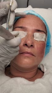 Eyebrow Tattoo result by Nubia Rozo Esthetic in Casselberry, FL