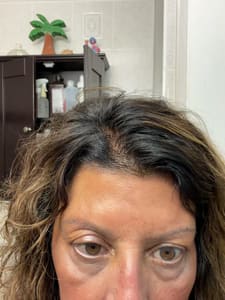 Eyebrow Tattoo result by NuYou Beauty Bar in Latham, NY