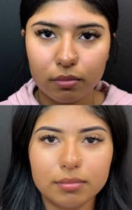 Eyebrow Tattoo result by Ombre Brows by Christina in Countryside, IL