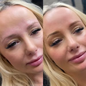 Eyebrow Tattoo result by Opulence Aesthetics LLC in Oakbrook Terrace, IL