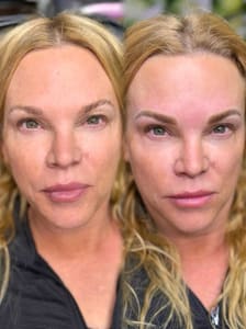 Eyebrow Tattoo result by Palm Beach Brow Boss in Palm Beach Gardens, FL