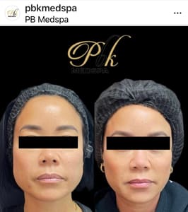 Eyebrow Tattoo result by PBK Medspa in Brooklyn, NY
