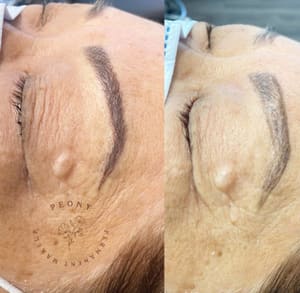 Eyebrow Tattoo result by Peony Permanent makeup in Calabasas, CA