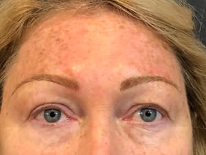 Eyebrow Tattoo result by Permanent Cosmetics by Amy / Skin City in Somers Point, NJ