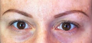 Eyebrow Tattoo result by Permanent Cosmetics by JudithMax in Fair Lawn, NJ