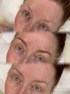 Eyebrow Tattoo result by Permanent Makeup by Gretchen LLC in Scott Depot, WV