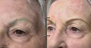 Eyebrow Tattoo result by Permanent Makeup of New York in Rochester, NY