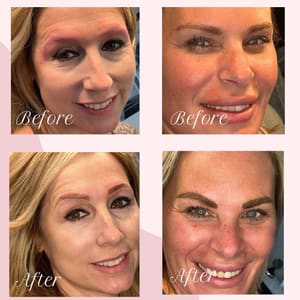 Eyebrow Tattoo result by Permanently Pretty in Red Bank, NJ
