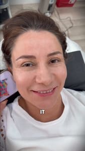 Eyebrow Tattoo result by Phistudio - SAS PMU Boca Raton in Boca Raton, FL