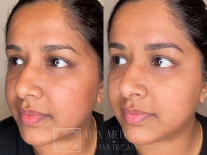 Eyebrow Tattoo result by Plume Brows in Sacramento, CA