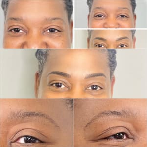 Eyebrow Tattoo result by PMU Scar Clinic in Henderson, NV