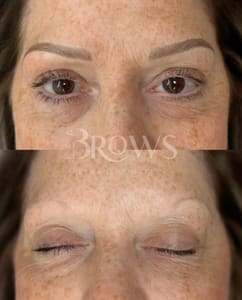 Eyebrow Tattoo result by Pretty Glow Brazilian Wax & Sugaring in Cumming, GA