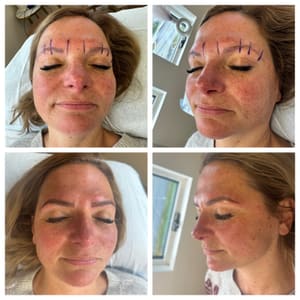 Eyebrow Tattoo result by Pretty In Ink in Salem, NH