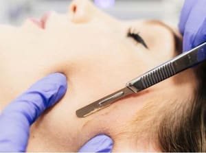 Eyebrow Tattoo result by Progressive Laser & Spa in Endwell, NY