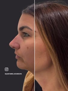 Eyebrow Tattoo result by Quantum Wellness Med Spa Chandler in Chandler, AZ