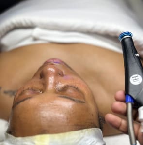 Eyebrow Tattoo result by Rêvelite Aesthetics, LLC in Temecula, CA