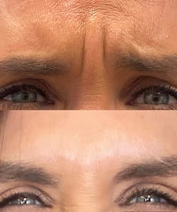 Eyebrow Tattoo result by Radiance Aesthetics & IV Infusion Bar in Terre Haute, IN