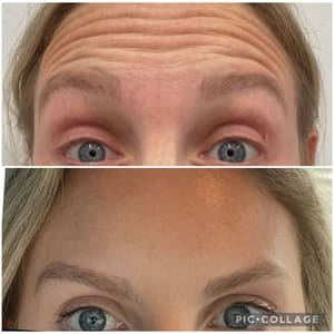 Eyebrow Tattoo result by Radiance Aesthetics & IV Infusion Bar in Terre Haute, IN