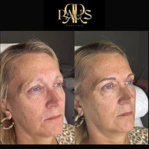 Eyebrow Tattoo result by Raus Brows & Skin at 201 in Jamestown, ND