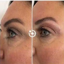 Eyebrow Tattoo result by Refine Body and Skin Care in San Diego, CA