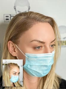 Eyebrow Tattoo result by RenewSMP LLC in Salinas, CA