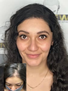 Eyebrow Tattoo result by RenewSMP LLC in Salinas, CA