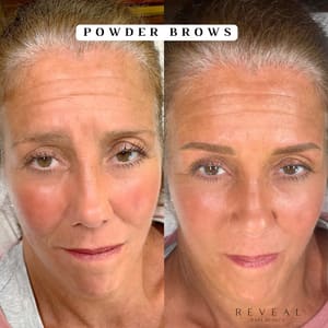 Eyebrow Tattoo result by Reveal Bare Beauty in Key Biscayne, FL