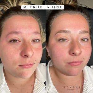 Eyebrow Tattoo result by Reveal Bare Beauty in Key Biscayne, FL