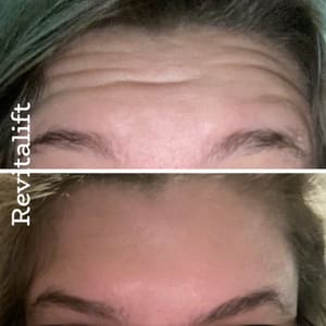 Eyebrow Tattoo result by Revitalift Aesthetic Center in Lincoln, NE