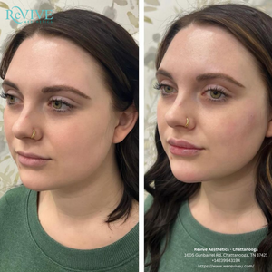 Eyebrow Tattoo result by Revive Aesthetics - Chattanooga in Chattanooga, TN