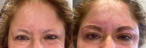Eyebrow Tattoo result by ReVive RX Med Spa in Kansas City, MO