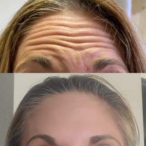 Eyebrow Tattoo result by Rewind Med Spa in Longmont, CO
