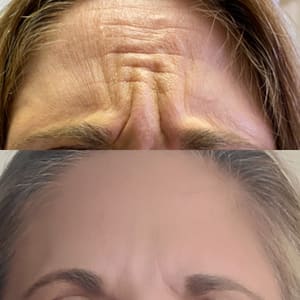 Eyebrow Tattoo result by Rewind Med Spa in Longmont, CO