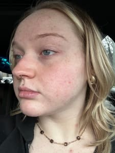 Eyebrow Tattoo result by Rilassare Esthetics in Murrysville, PA