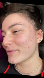 Eyebrow Tattoo result by S2G Medical Spa in West Bloomfield Township, MI