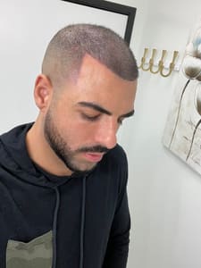 Eyebrow Tattoo result by Scalp and Brows NJ in Totowa, NJ