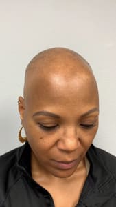 Eyebrow Tattoo result by Scalp Evolution - Scalp Micropigmentation Miami SMP - Micropigmentacion Capilar in Miami, FL