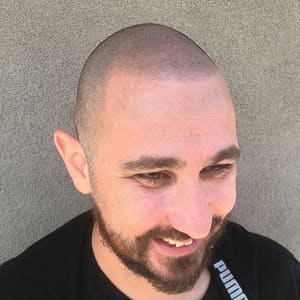 Eyebrow Tattoo result by Scalp Micro Boise in Garden City, ID