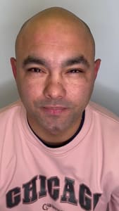 Eyebrow Tattoo result by Scalp Micro Pro Clinic in Rancho Cucamonga, CA