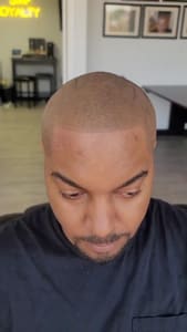 Eyebrow Tattoo result by Scalp Micropigmentation - The Art of SMP New York in New Rochelle, NY