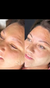 Eyebrow Tattoo result by SD ibrows in San Diego, CA