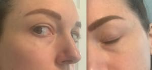 Eyebrow Tattoo result by Shine Medspa & Microblading in Wakefield, MA
