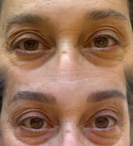 Eyebrow Tattoo result by Signature Beauty Clinic in Lakewood Ranch, FL