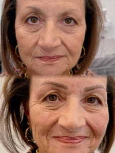 Eyebrow Tattoo result by Simply Beauty by Tina in Hoover, AL