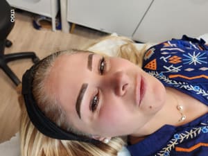 Eyebrow Tattoo result by Simply Smooth 360 in West Palm Beach, FL