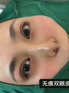 Eyebrow Tattoo result by Sister Eyebrow Tattoo in Flushing, NY