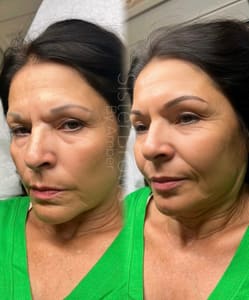 Eyebrow Tattoo result by SisterBrows in Albuquerque, NM